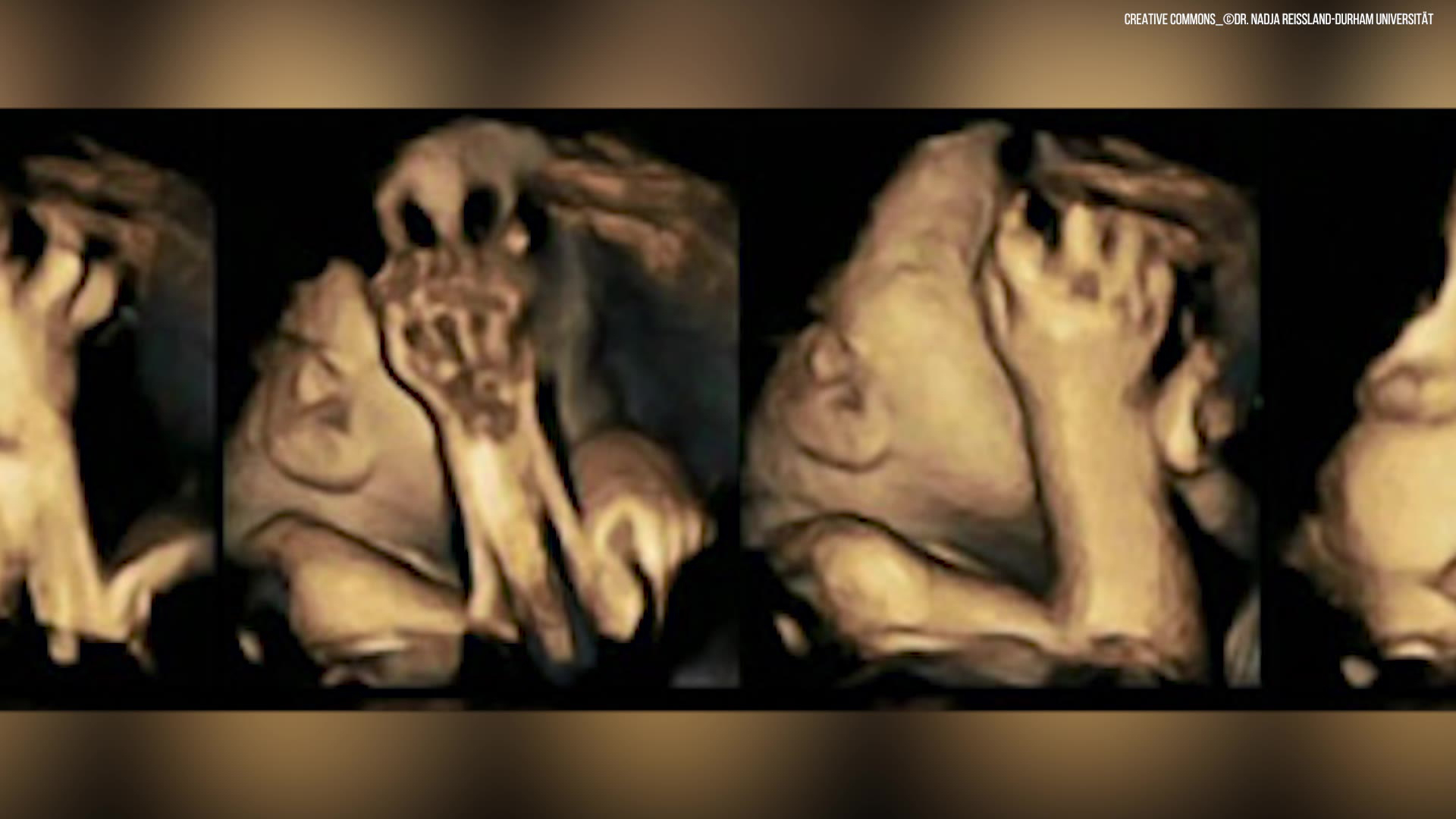 Diese Bilder Zeigen, Was Rauchen In Der Schwangerschaft Dem Kind Antut verwandt mit Was Passiert Beim Rauchen In Der Schwangerschaft