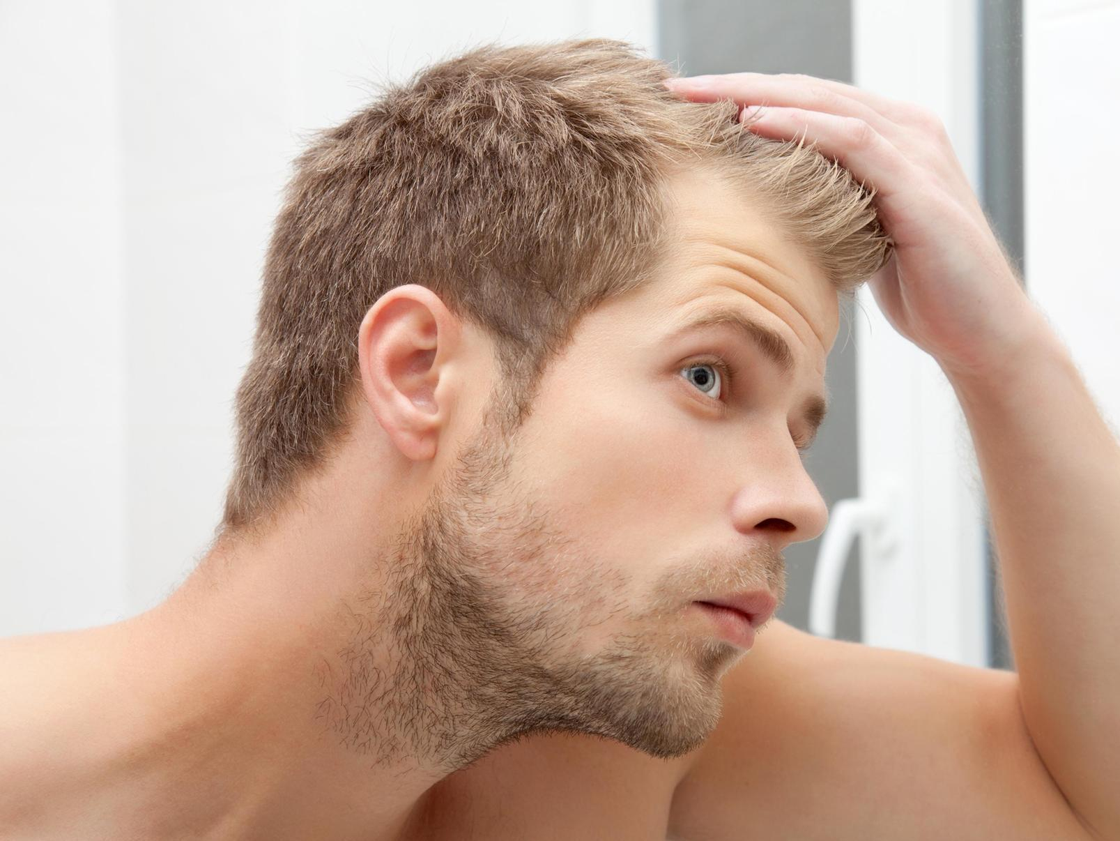 Glatze: So Kaschieren Sie Kahle Stellen verwandt mit Wie Viele Haare Hat Man Auf Dem Kopf