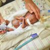 Künstlicher Mutterleib Soll Frühchen Helfen für Baby Atmet Nach Geburt Nicht Selbstständig