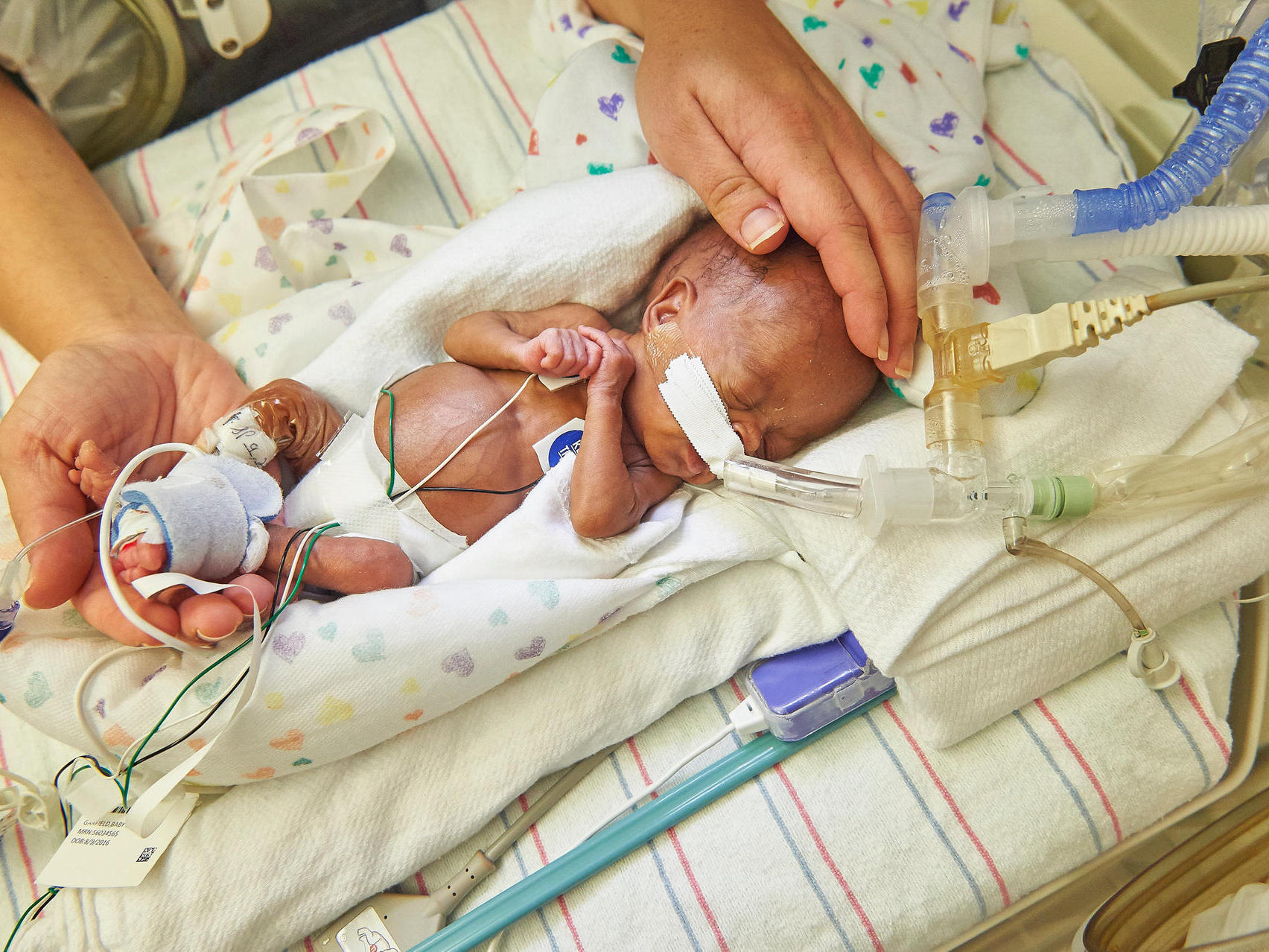 Künstlicher Mutterleib Soll Frühchen Helfen für Baby Atmet Nach Geburt Nicht Selbstständig