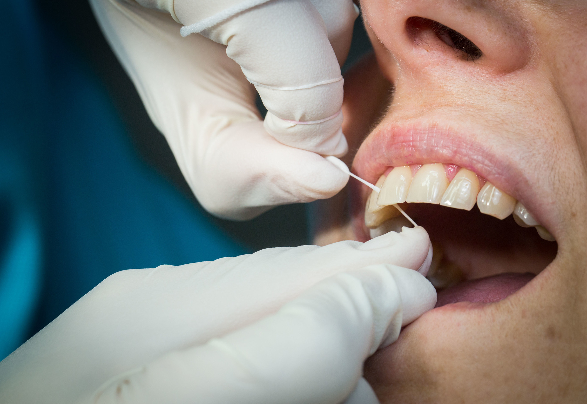 Lücken In Der Versorgung - Vermischtes Aus Deutschland über Alle Zähne Ziehen Unter Vollnarkose