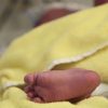 Rätselhafter Patient: Atemstillstand Bei Baby Nach Geburt innen Baby Atmet Nach Geburt Nicht Selbstständig