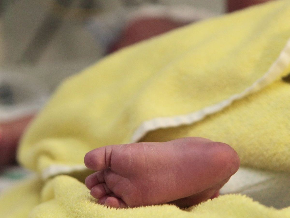 Rätselhafter Patient: Atemstillstand Bei Baby Nach Geburt innen Baby Atmet Nach Geburt Nicht Selbstständig