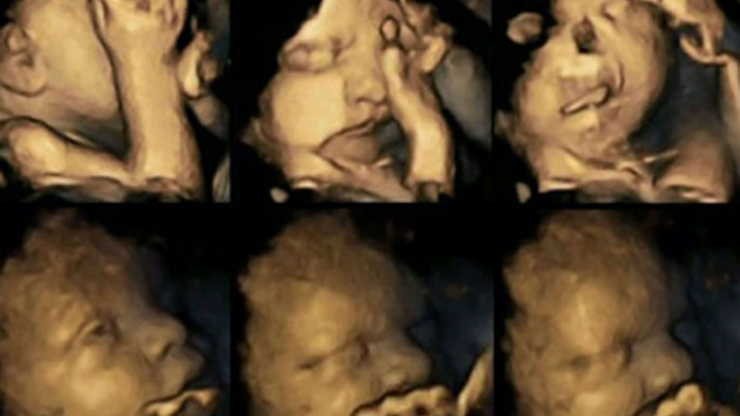 Wenn Schwangere Rauchen: So Reagieren Babys Im Mutterleib ganzes Was Passiert Beim Rauchen In Der Schwangerschaft