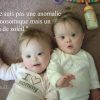 Adorables Et Éternelles Enfants | Cute Twins, Down für Bilder Kinder Trisomie 21
