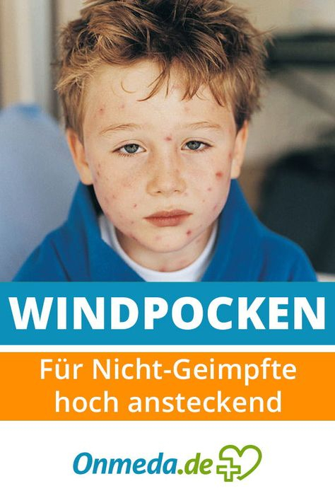 Die 50+ Besten Bilder Zu Kinderkrankheiten In 2020 mit Windpocken Kinder Bilder