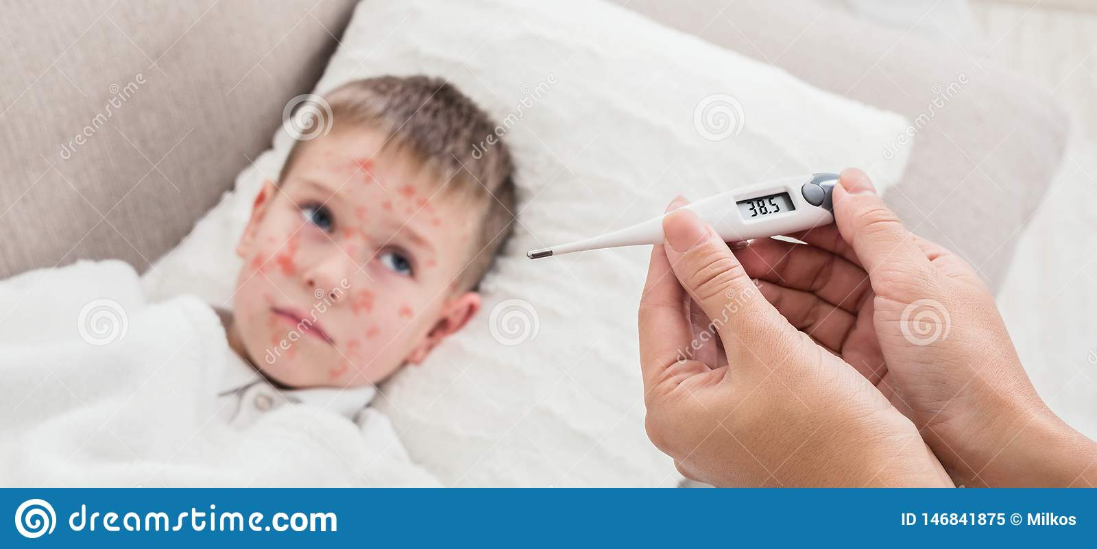 Hohes Fieber-Masern-Virus Mutter-Messende Temperatur Des bei Nesselsucht Kinder Bilder