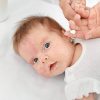Neurodermitis Beim Baby - Symptome, Ursachen &amp; Behandlung innen Neurodermitis Kinder Bilder
