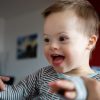 Was Versteht Man Unter Dem Down-Syndrom? - Berliner Morgenpost mit Kinder Angelman Syndrom Bilder