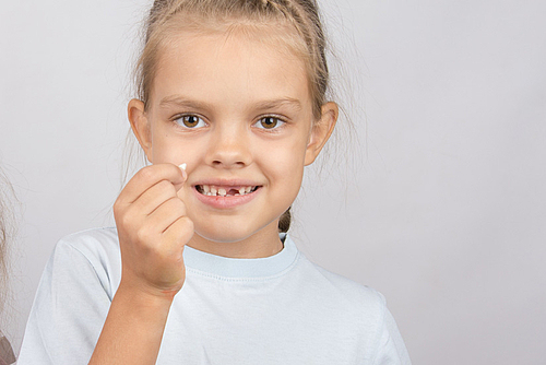 Bleibende Zähne Mit Milchzähnen Regenerieren: Dents.de bei Schwarze Zähne Kinder Bilder