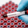 Coronavirus: Eine Neuinfektion Bei 369 Abstrichen - Vox News Südtirol ganzes Corona Ausschlag Kinder Bilder