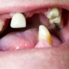 Demenzrisiko: Darum Schädigen Schlechte Zähne Ihr Gehirn bestimmt für Kinder Bilder Einschliesslich Machen Lassen