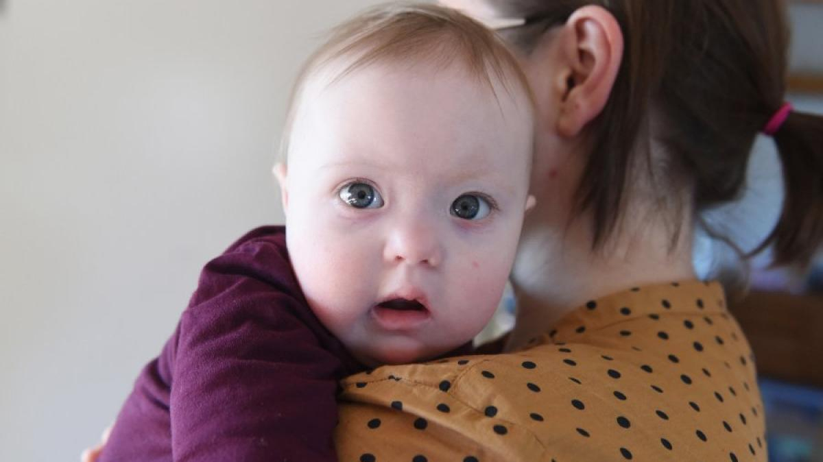 Down-Syndrom: Trisomie 21: Neun Von Zehn Entscheiden Sich Für für Bilder Kinder Mit Down Syndrom
