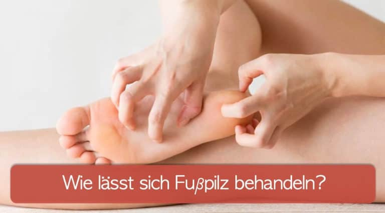 Fußpilz Behandeln Mit Creme, Spray Oder Gel? (September 2021) in Dornwarze Kinder Bilder