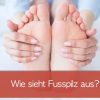 Fußpilz Erkennen! 4 Bilder Der Symptome (August 2021) über Dellwarzen Kinder Bilder