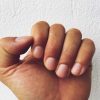Gelbe Fingernägel: Ursache - Was Kann Man Dagegen Machen? mit Dellwarzen Kinder Bilder