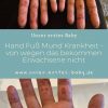 Hand Mund Fuß Krankheit Beginn - Quotes Type bestimmt für Hand Mund Fuß Krankheit Kinder Bilder