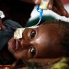 Hungersnot In Ostafrika: Immer Mehr Kinder Sterben In Den bei Unterernährte Kinder Bilder