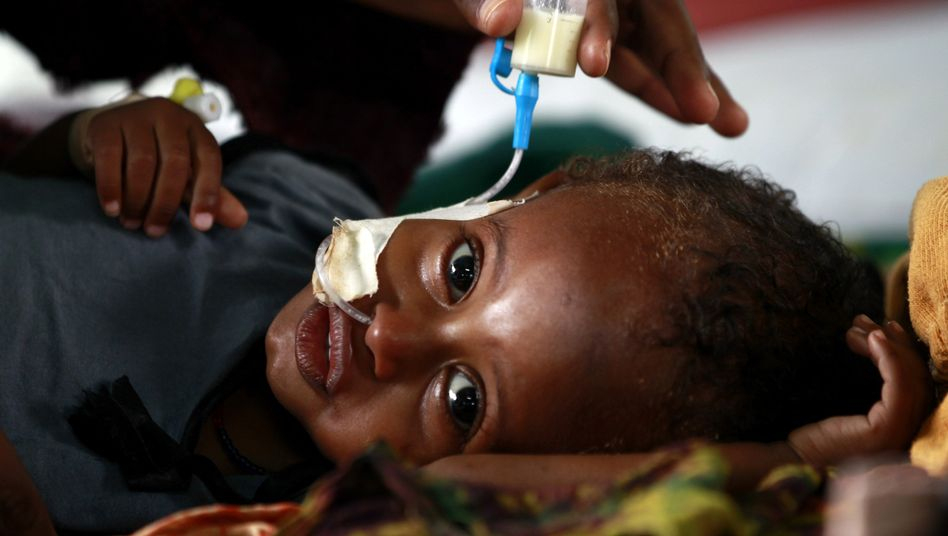 Hungersnot In Ostafrika: Immer Mehr Kinder Sterben In Den bei Unterernährte Kinder Bilder