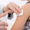 Impfen - Impfungen Gegen Infektionskrankheiten - Naturheilkunde innen Pocken Kinder Bilder