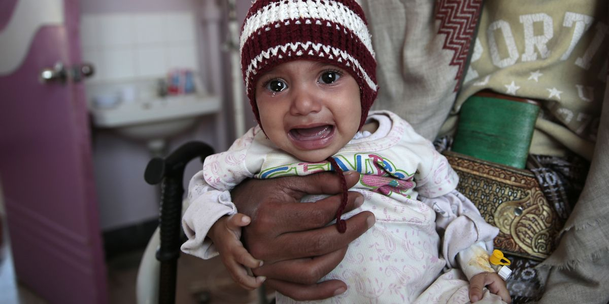 Jemen: Hunderttausende Kinder Von Hungertod Bedroht - Der Spiegel verwandt mit Verhungernde Kinder Bilder