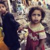 Jemen: Mehr Als Eine Million Kinder Von Unterernährung Betroffen mit Verhungernde Kinder Bilder