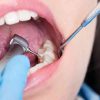 Karies-Behandlung Ohne Bohren - So Funktioniert Die Neue Methode für Faule Zähne Kinder Bilder