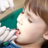 Karies Bei Kleinkindern Nimmt Immer Mehr Zu - Heilpraxis innen Karies Zähne Kinder Bilder
