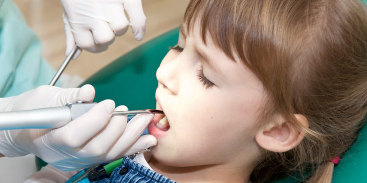 Karies Bei Kleinkindern Nimmt Immer Mehr Zu - Heilpraxis innen Karies Zähne Kinder Bilder