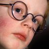 Kinderkrankheiten: Ringelröteln bei Scharlach Symptome Kinder Bilder