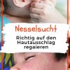 Nesselsucht Bei Kindern: Woher Kommt Der Juckende Ausschlag In 2020 für Kinder Hautausschlag Bilder