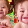 Süßes Mädchen Mit Down-Syndrom Wird Zum Internet-Hit, Als Sie Für Ihre bei Fette Kinder Bilder