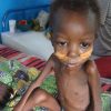 Trotz Hoher Lebensmittelproduktion: 870 Millionen Leere Bäuche - N-Tv.de in Kinder Afrika Bilder Hunger