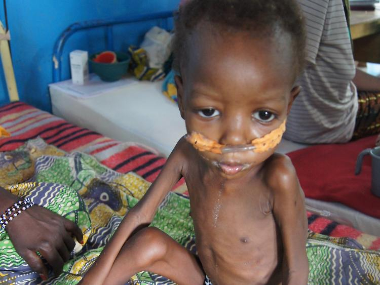 Trotz Hoher Lebensmittelproduktion: 870 Millionen Leere Bäuche - N-Tv.de in Kinder Afrika Bilder Hunger