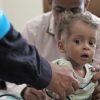 Unicef Bezeichnet Lage Im Jemen Als Hölle Für Kinder - Pars Today ganzes Verhungernde Kinder Bilder
