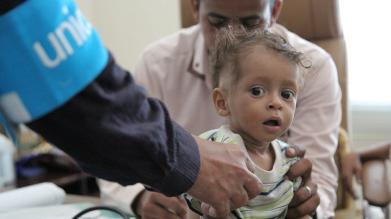 Unicef Bezeichnet Lage Im Jemen Als Hölle Für Kinder - Pars Today ganzes Verhungernde Kinder Bilder