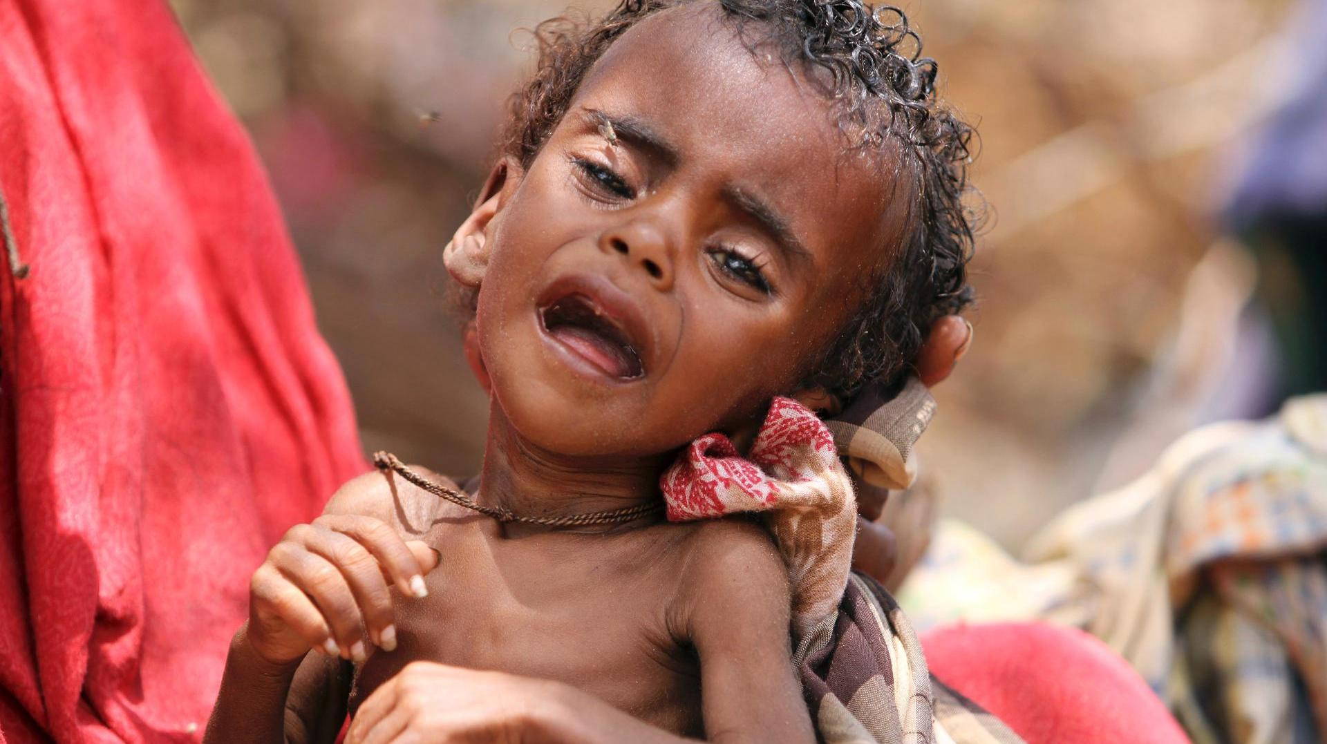 Unicef Warnt: 69 Millionen Kinder Könnten Bis 2030 Sterben bestimmt für Kinder Bilder,