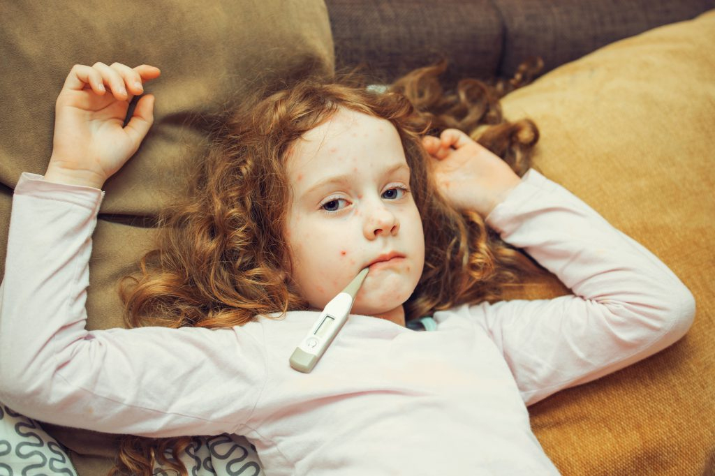Windpocken - Wann Macht Eine Impfung Sinn? | Heimarbeit.de √ für Pocken Kinder Bilder